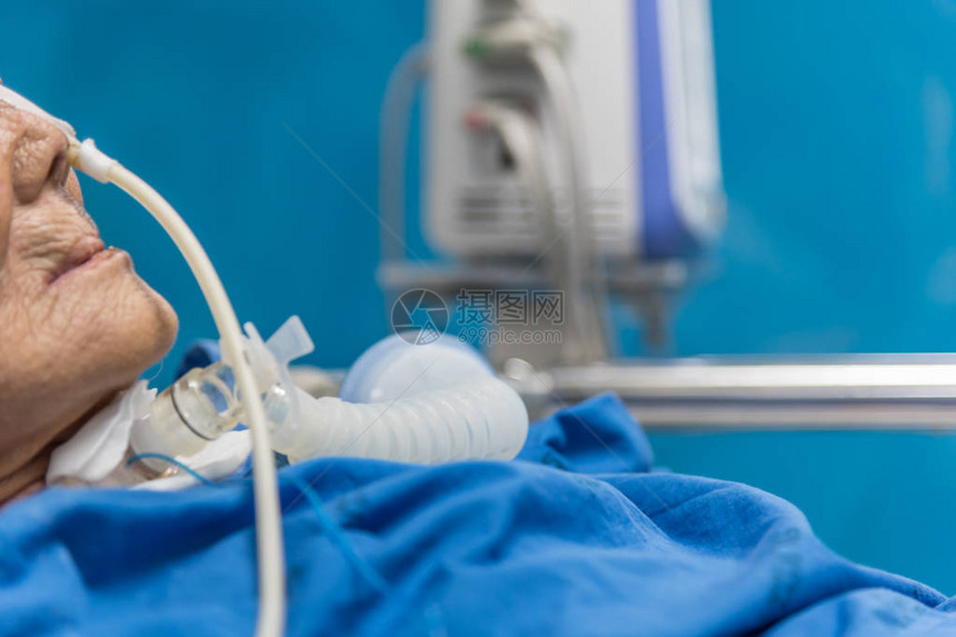 80多岁的亚洲老年女患者在医院重症监护室ICU病房的病床上使用呼吸机进行气管切开术进行图片