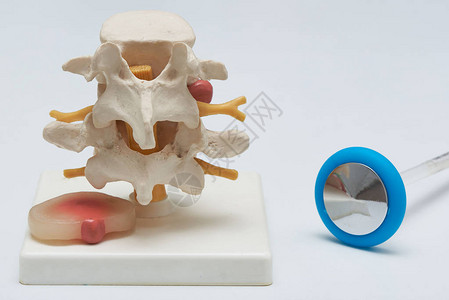 人造腰椎模型和椎间盘突出的后视图在白色背景在医疗办公室的桌子上的一图片