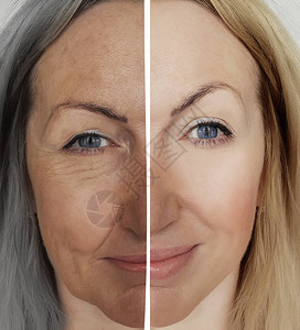 女人在衰老前后皱纹的概念图片