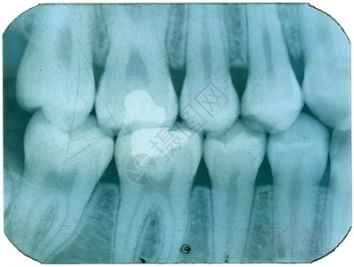 牙齿状况不良的旧图片