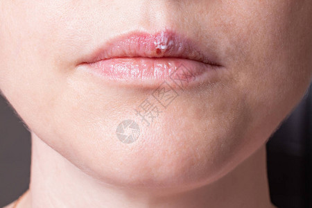 女人脸部的一部分嘴唇上的图片