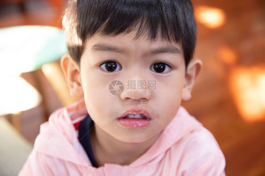鼻子里流出的鼻孔很近的黏液亚洲男孩有一只鼻图片