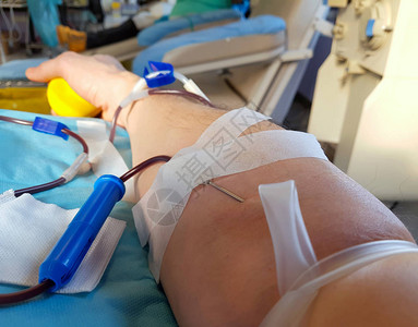 在医院献血时年轻志愿者的手臂用止图片