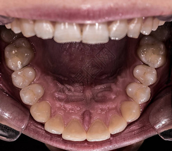 从底部看人体健康最大功能牙齿和味图片