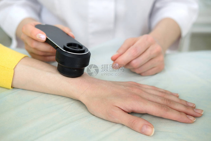 女皮肤科医生在进行皮肤检查时使用专业的皮肤镜检查手头的良痣皮肤科医生检查女患者的胎记和痣图片