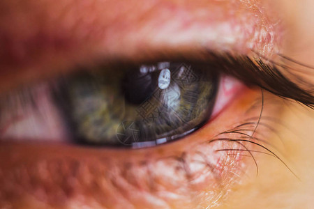 用鲜红色的动脉打开人眼关闭眼球刺激和发红瞳孔虹膜睫毛在宏图片