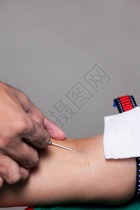 护士的手用复制空间将针刺入献血者手臂高清图片