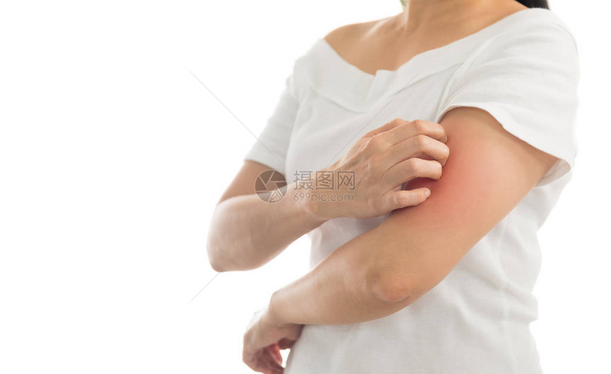 女使用手抓的皮肤疾病痒图片