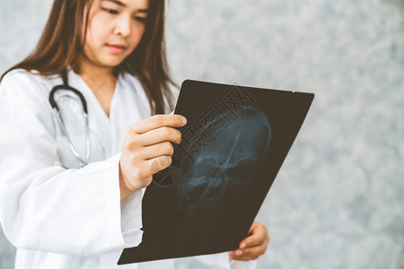 年轻的女医生在医院查看患者头部或脑部疾病的X光片医疗保健和图片