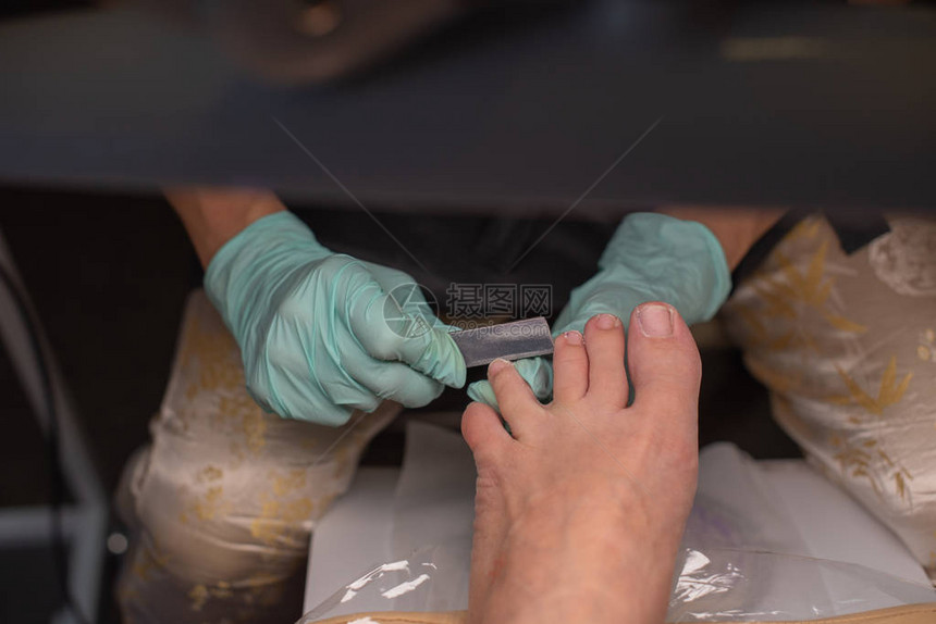 足病医生治疗脚趾甲足病治疗应用凝胶抛光去除甲剥离的Podology在医疗办公室与足科医生一起治疗图片