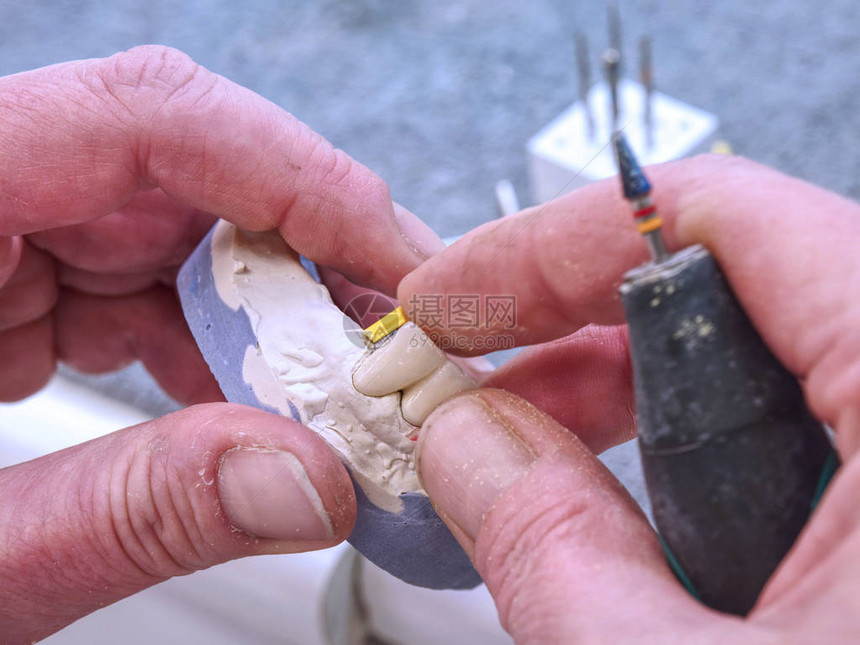 牙医用牙医金刚石工具或手术刀铣牙科金属结构在义齿实验图片