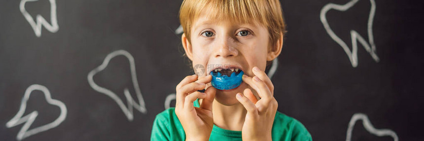 六岁男孩长的FORMATLongFORMAT展示了神经功能训练师帮助平衡牙齿生长和正确的咬痕图片