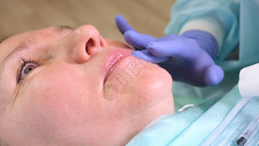 丰唇美容师医生用注射器对女嘴唇进行美容手术老图片