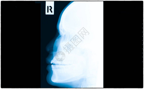 医院X射线头部体检图片