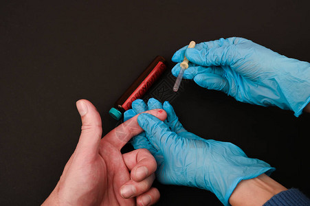 检查患者的冠状医生进行生化血液检查以检测冠状从手指取血进行诊断特写图片