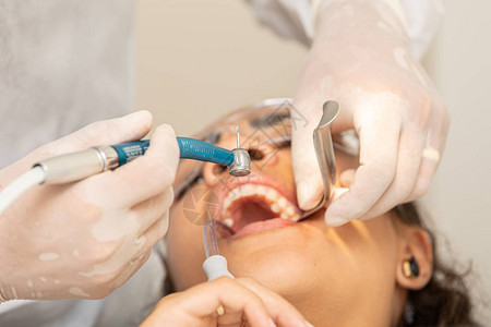 在牙医办公室看到的年轻女子牙痛智齿拔除麻醉龋齿或牙龈问题的概念口腔背景图片