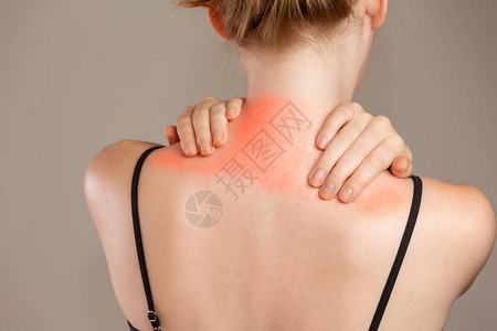 女人颈部疼痛在痛处有红色的亮图片