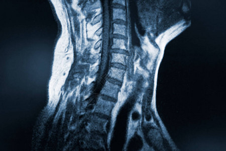 病人子宫颈磁扫描仪健康和医学概念图片
