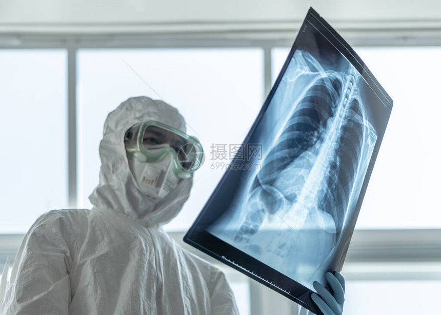 COVID19冠状或新型冠状流行病与医生或实验室技术科学家在PPE个人防护设备中持有肺胸部X射线图像图片