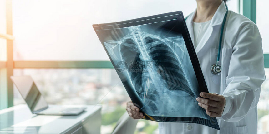 医生用放射胸部X光片诊断哮喘肺病COVID19或骨癌疾病的患者健康状况图片