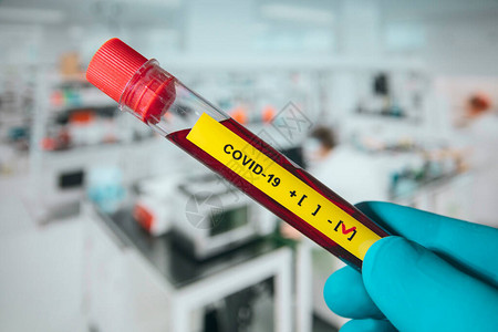 Corona血液测试概念图片