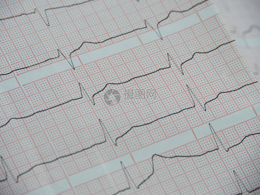 白纸上的心脏电图红色的细胞在一图片