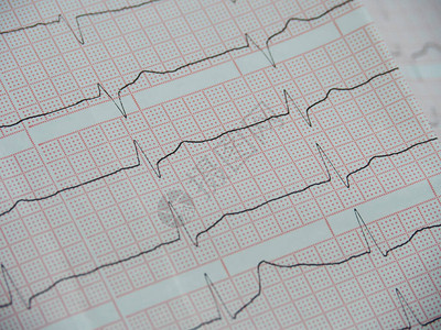 白纸上的心脏电图红色的细胞在一图片