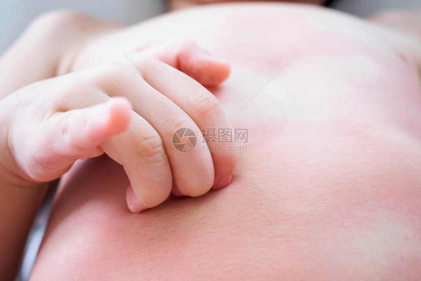 幼小的年幼女婴手抓着她的身体皮肤图片
