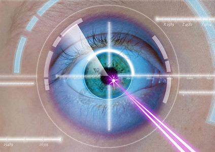 眼部激光手术屈光度眼部图片