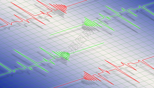 心电图解背景图片