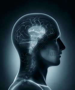 脑干医学X射线扫描图片