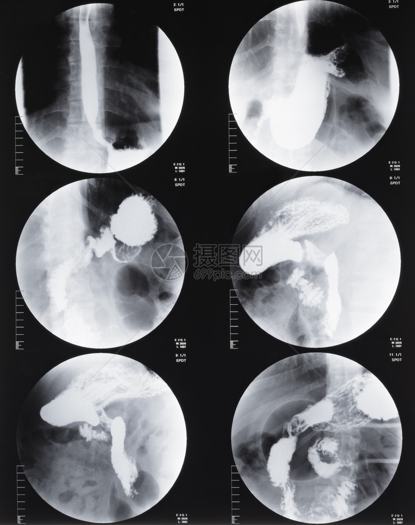 胃和肠的磁共振断层扫描图片