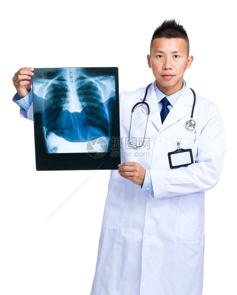 穿白大褂的亚洲男医生带X光片图片