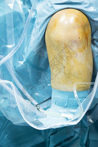 医院整形外科腿外科手术室图片