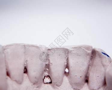 牙医实验室照片中的牙科假图片