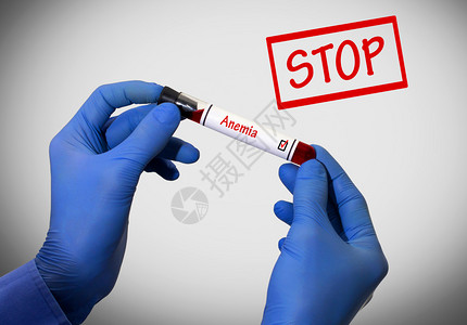 停止贫血液测试的阳结果医生手上进行血检的试管医学概念图片