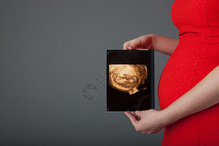 孕妇展示其腹部和超声波婴图片