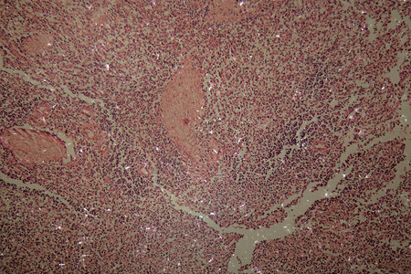 显微镜下的人类卵巢细胞和Ovari图片