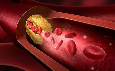 红细胞血管变窄Erythrozyt背景图片