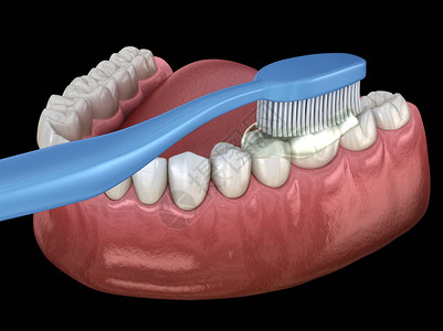 牙刷清洁牙齿口腔卫生的医学上准确的3D插图图片