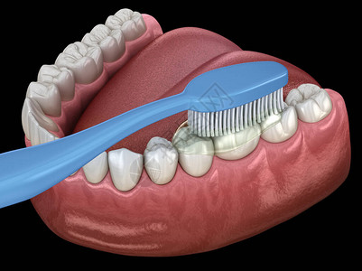 牙刷清洁牙齿口腔卫生的医学上准确的3D插图图片