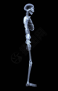 人体骨骼的X射线侧视图图片