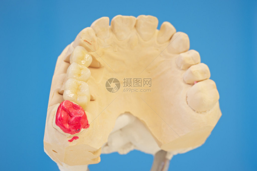 牙科实验室牙齿假牙模型图片