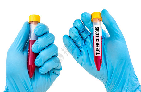 科学家用蓝橡胶手套握着一个带有血样的试管图片