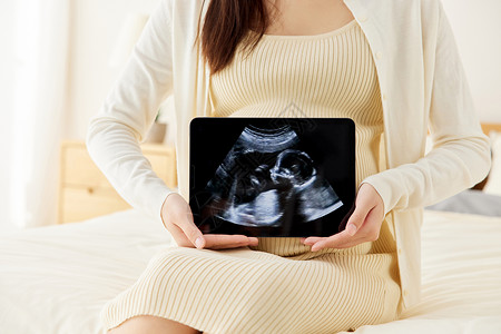 怀孕照片怀孕准妈妈手拿b超图特写背景