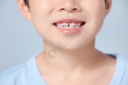 小男孩的牙齿特写高清图片