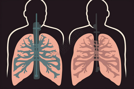 人体肺部图标图片