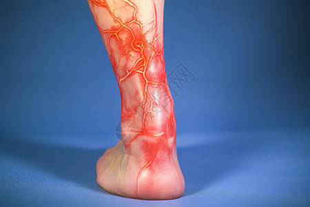 腿部血管疼痛图片