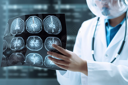 颅脑ct医生观察手上的CT脑部CT背景