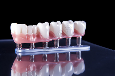 人工种植牙牙科正畸牙齿模型背景
